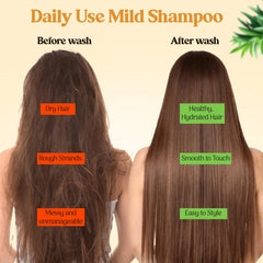 Touché Wellness Follinature Shampoo | Plant Based Herbal Daily Use Shampoo | With Neem - Amla - Aloevera - Rosemarry extract - Almond Oil | Gentle & Mild Cleansing | For All Hair Types - 200 ml My Store